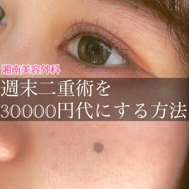 二重になる方法 のび る アイテープ 絆創膏タイプ Daisoの使い方や二重メイク こんにちは ふじりちゃ By ふ じ り ち ゃ ん 脂性肌 10代後半 Lips