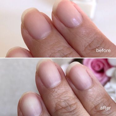 クイックスムージングベース ネイリストの口コミ 爪表面の縦ジワや凸凹を埋めてフラットにする By 𝐥𝐢𝐬𝐚 𝟏𝟔𝟓𝟔 フォロバ100 混合肌 30代後半 Lips