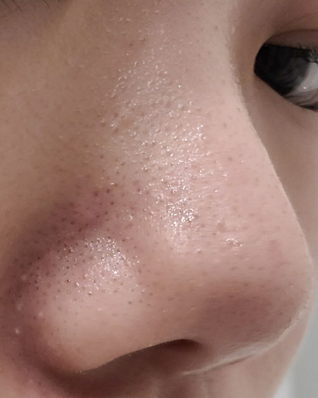 ホホバオイル 無印良品を使った口コミ 初めまして 2枚目からほんとに閲覧注意です By Kana 10代前半 Lips