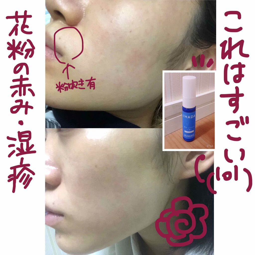 傾斜 仲人 レクリエーション イハダクリーム Cloudap Jp