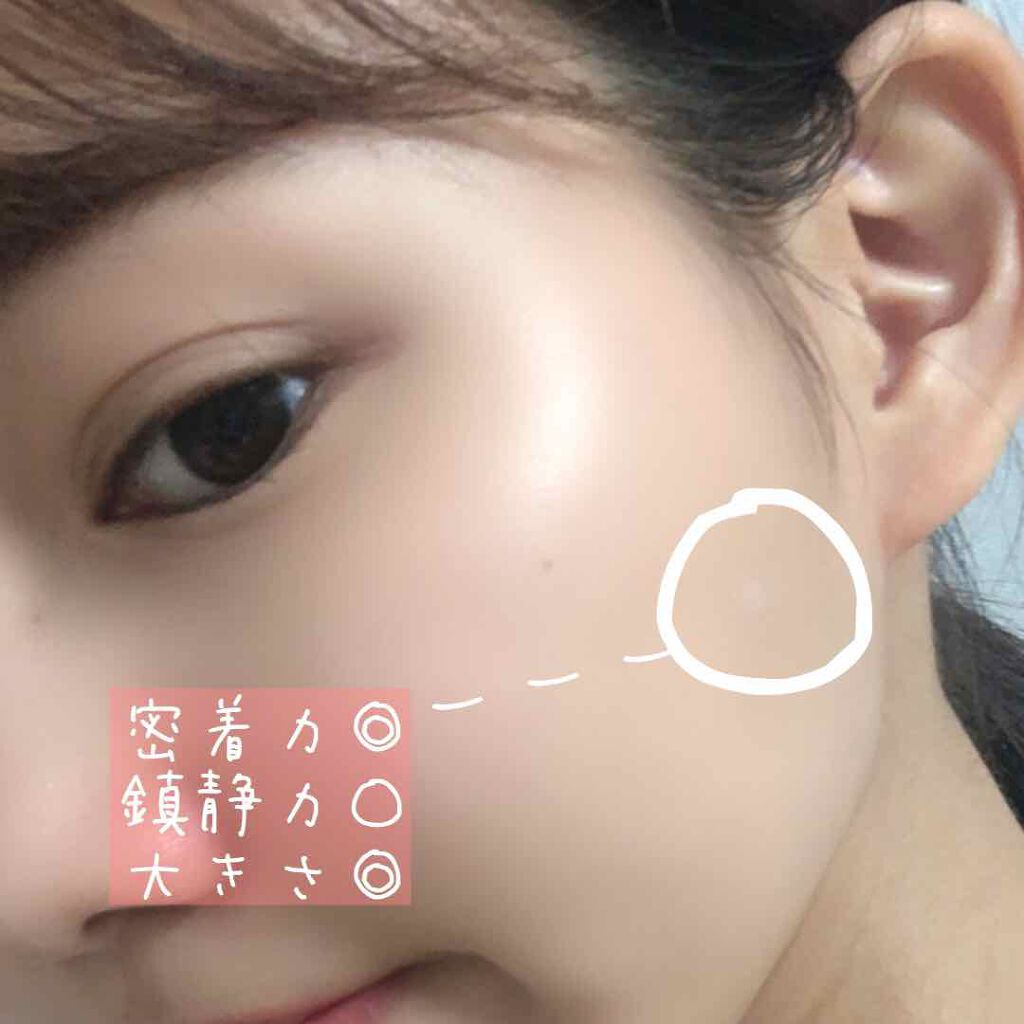 ニキビパッチ Olive Youngの口コミ やはりニキビパッチは大事だな と思ったの By Airi O 乾燥肌 代後半 Lips