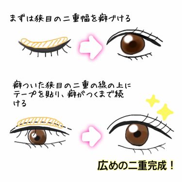 ヌード二重まぶたシール Daisoの口コミ 超優秀 100均で買えるおすすめ二重まぶた用アイテム 一重気味の奥二重だった By ぴよ 敏感肌 代前半 Lips