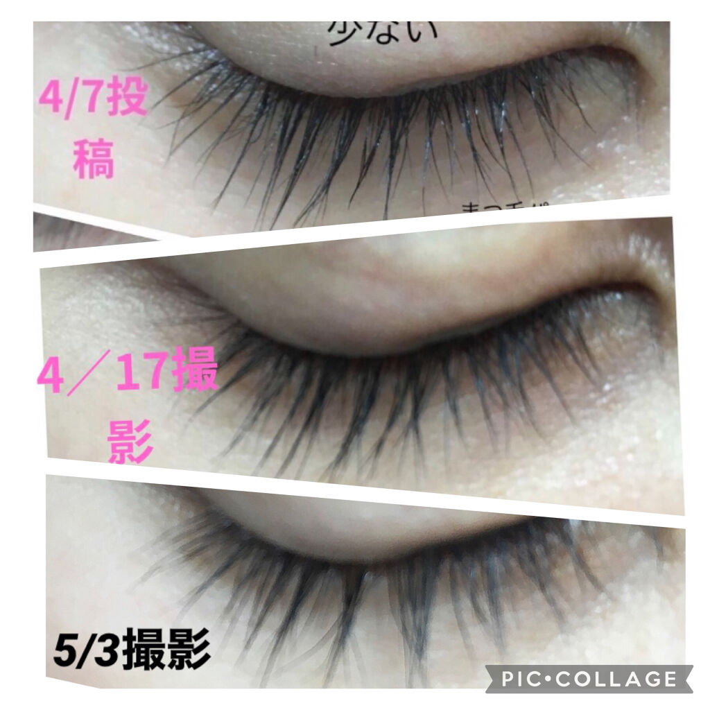 エグータム アルマダスタイルの効果に関する口コミ めちゃくちゃ伸びるまつ毛美容液 使用開始か By ちゃんみ フォロバ強化中 投稿ある方 普通肌 Lips