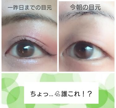 ザ リンクレス One By Koseの効果に関する口コミ ワンバイコーセーザリンクルレス シワ改善ク By アラフィフ 11 Lips