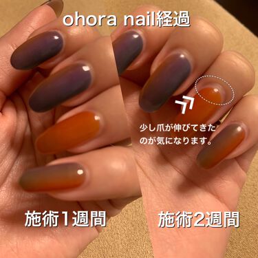 セミキュアジェルネイル ハンド Ohoraの口コミ 施術2週間後の比較ohoranailをセル By マリリン 30代前半 Lips