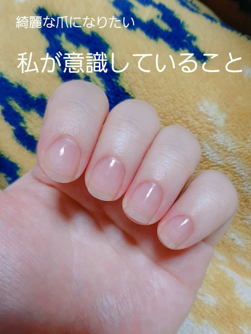 ベビークリアオイル ピジョンを使った口コミ 物心ついた頃から爪噛みグセがあった私の育爪 By いつユータンや 混合肌 30代前半 Lips