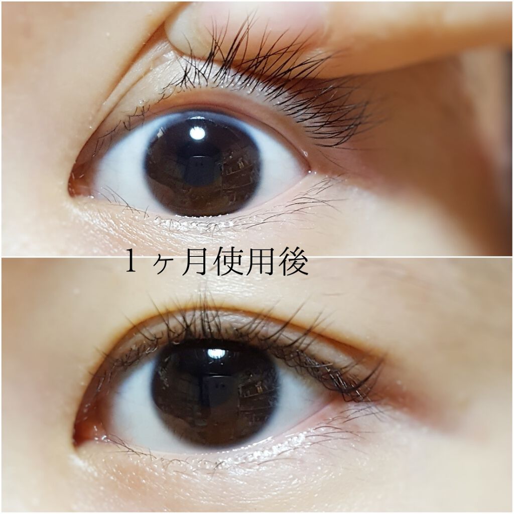 グロウアイラッシュセラム フェースの口コミ 圧倒的な結果 詳しくは画像で セルベスト化 By 銀麦 スキンケアマニア 混合肌 10代後半 Lips