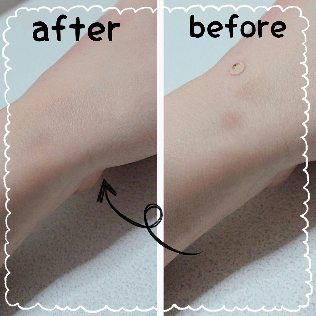 ラディアントクリーミーコンシーラー Narsの口コミ ずっと探してた 脂性肌でもよれないコ By めろん 混合肌 Lips