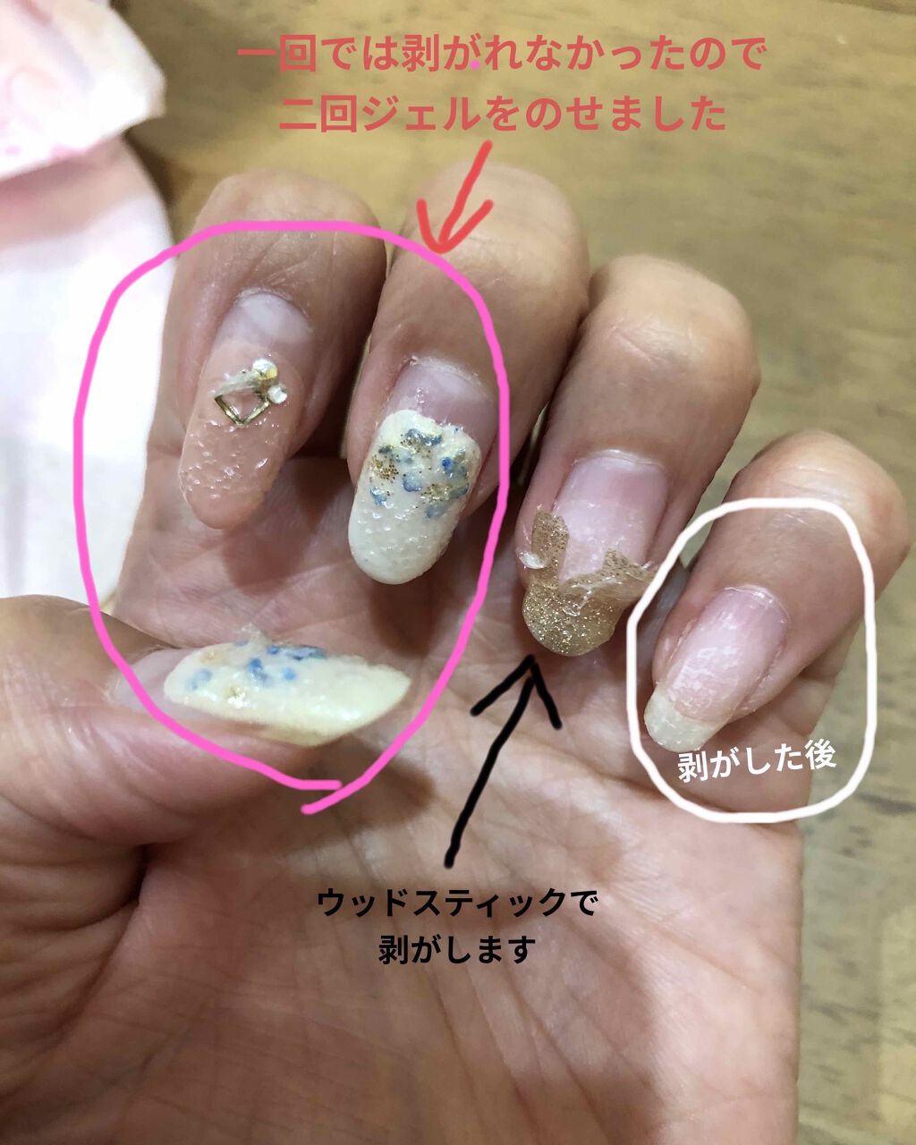 ジュレリムーバー Decorative Nailの使い方を徹底解説 ジェルネイルのオフを簡単に ジュレをの By くろみ 脂性肌 30代後半 Lips