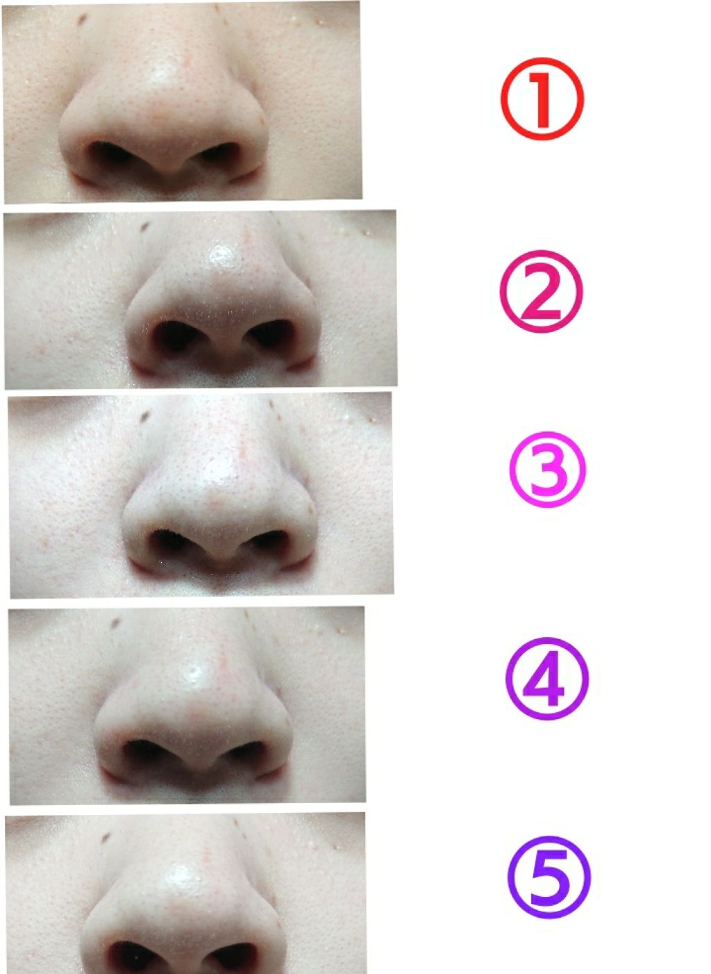 ウォッシャブル コールド クリーム ちふれの効果に関する口コミ コールドクリームは黒ずみに効くのか By つう 乾燥肌 代後半 Lips