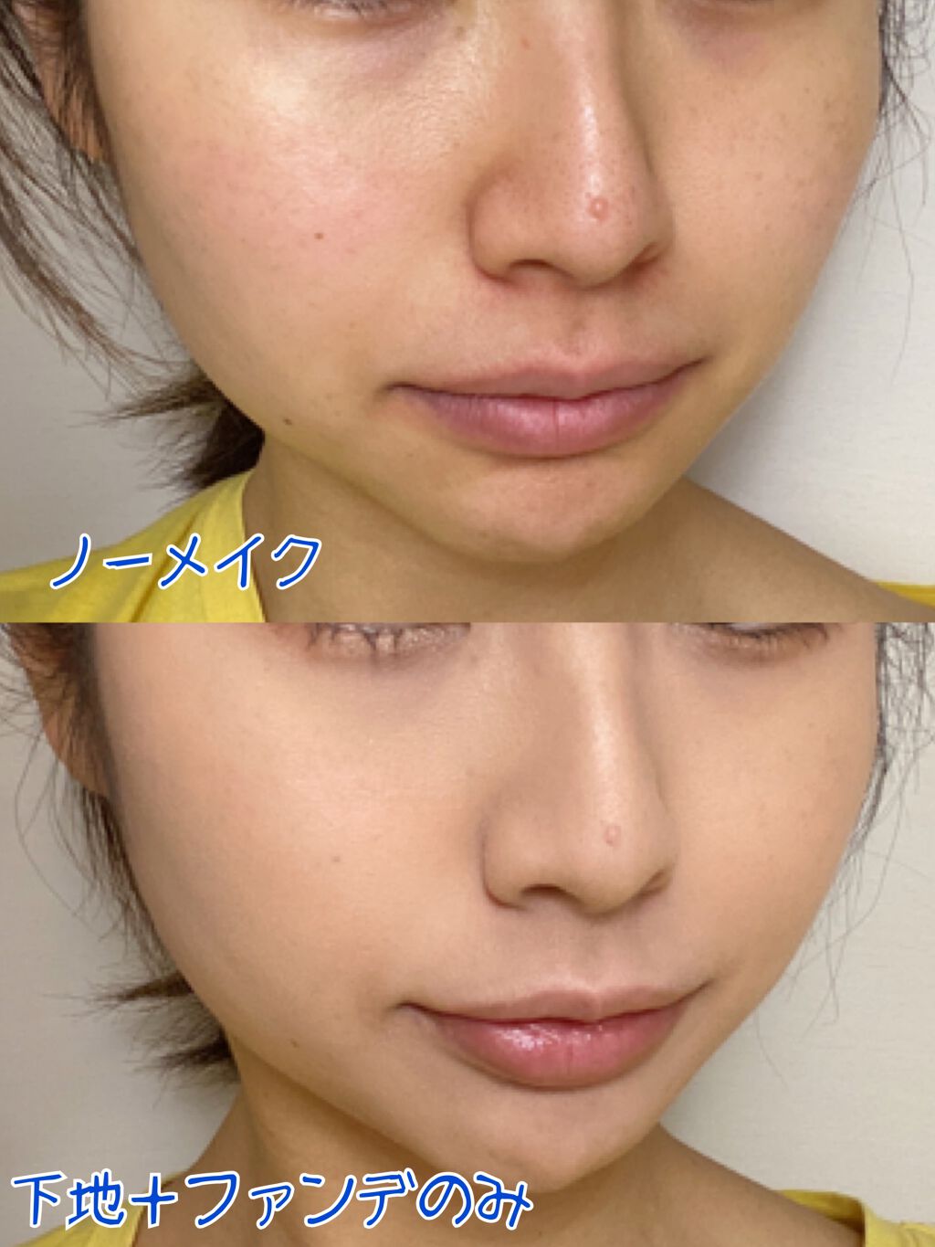 ドラマティックパウダリーex マキアージュの人気色を比較 写真3枚目以降 汚肌のアップとぐちゃぐ By いずみひょーかん アトピー肌 代後半 Lips
