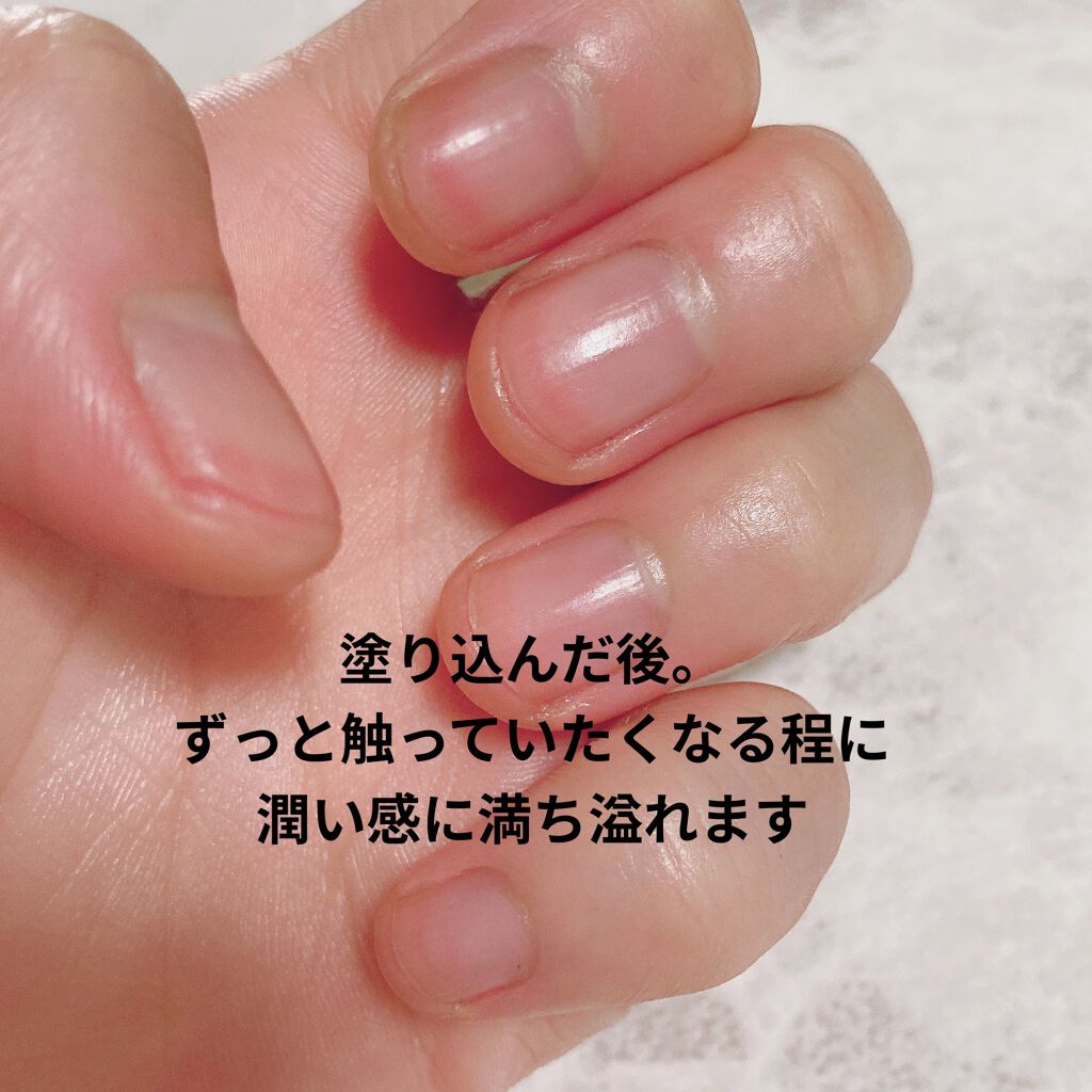 ナイトリニューハンドクリーム コエンリッチq10の口コミ 仕事柄 深爪ネイル不可おまけに毎日長時間ゴ By ブルベ夏みかん ˊ ˋ 敏感肌 代後半 Lips
