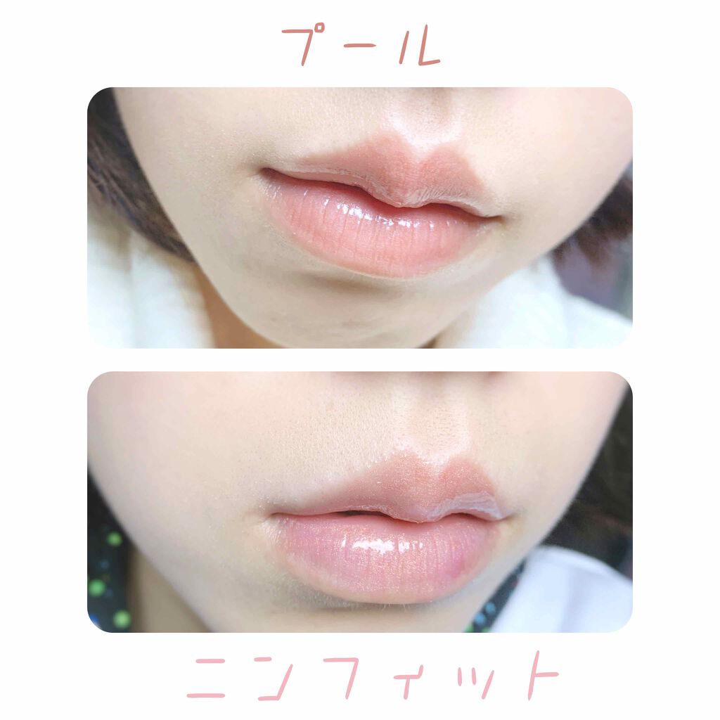 リップガラス M A Cの口コミ イエベにおすすめのリップグロス 3枚目唇の写真です By みいこすめ 敏感肌 Lips