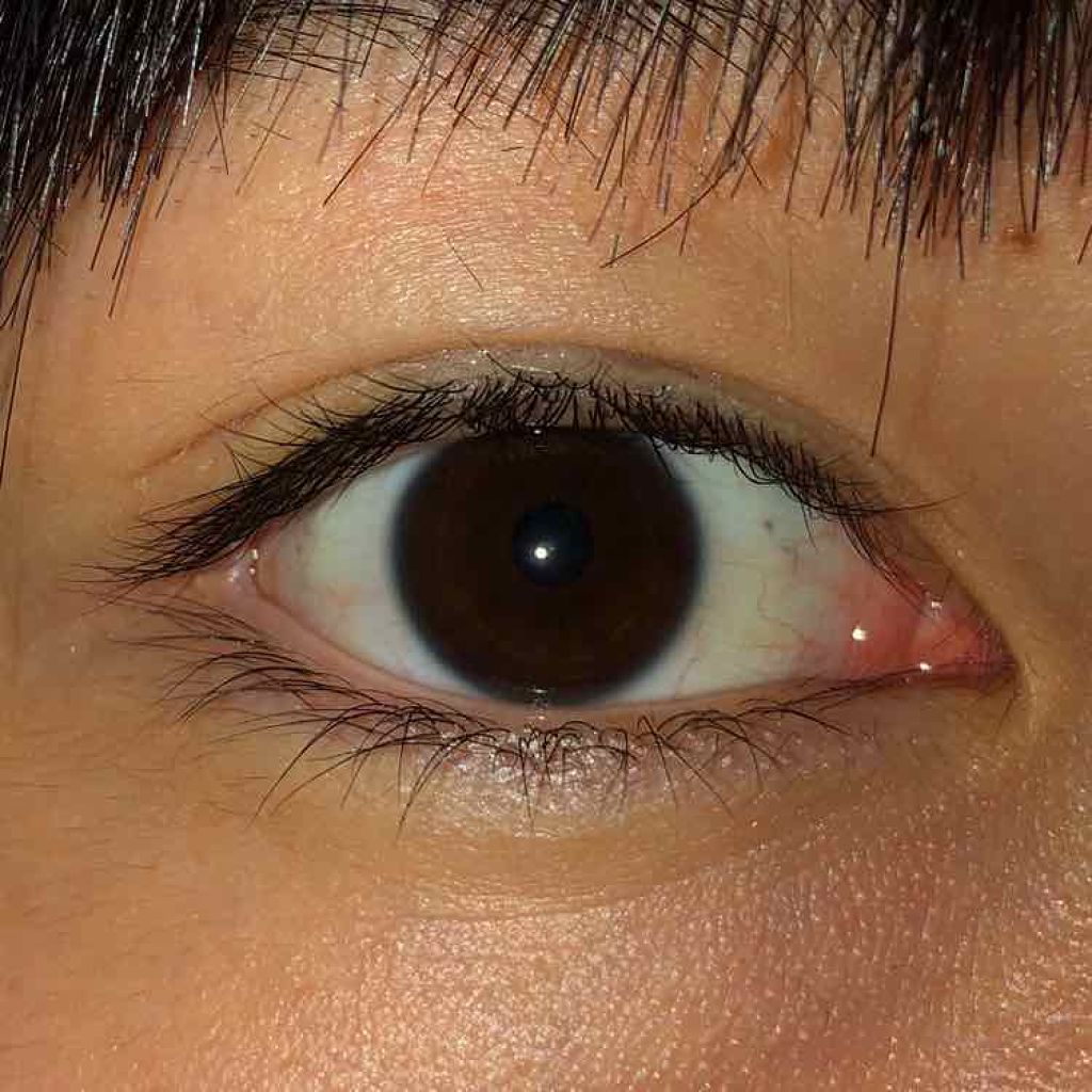 大人のルドゥーブル ルドゥーブルの口コミ 激重まぶたの私が二重を手に入れた方法を紹介 By Makuri 混合肌 10代後半 Lips