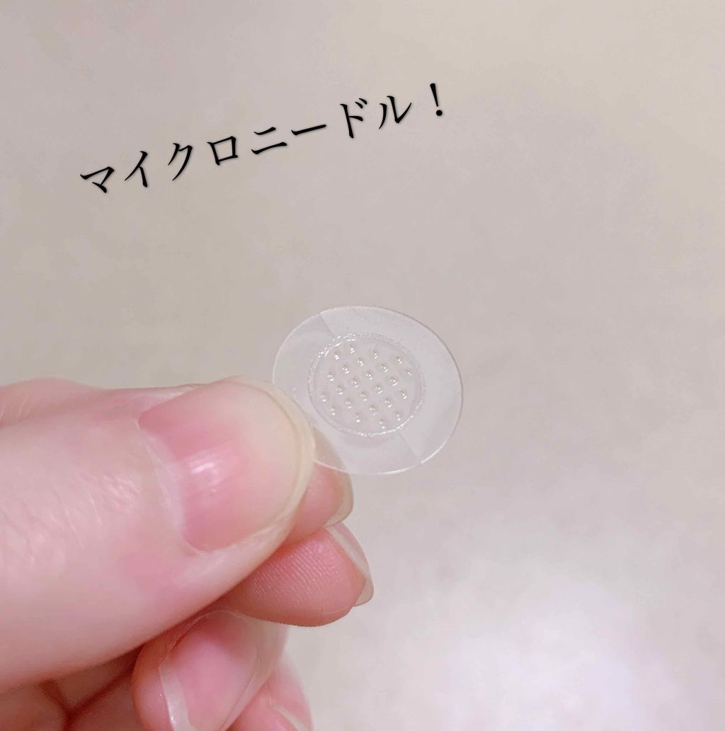 マイクロニードルを炎症に直接プスッと