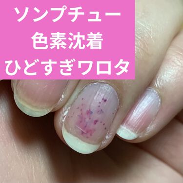 ソンプチュー Daisoの辛口レビュー ショックだったので注意喚起として投稿です By べに丸 混合肌 代前半 Lips