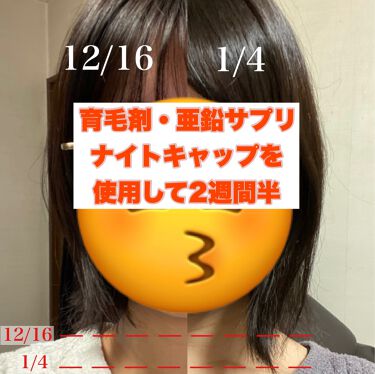 亜鉛 30日分 栄養機能食品 亜鉛 Dhcを使った口コミ ヘアアクセルレーター 亜鉛サプリ ナイトキ By 散財大学生 乾燥肌 代前半 Lips