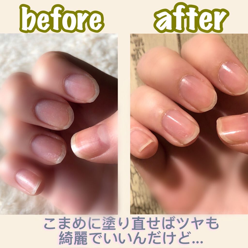 序文 読みやすさ 寄付 マニキュア 塗り 直し 頻度 Pritown Jp