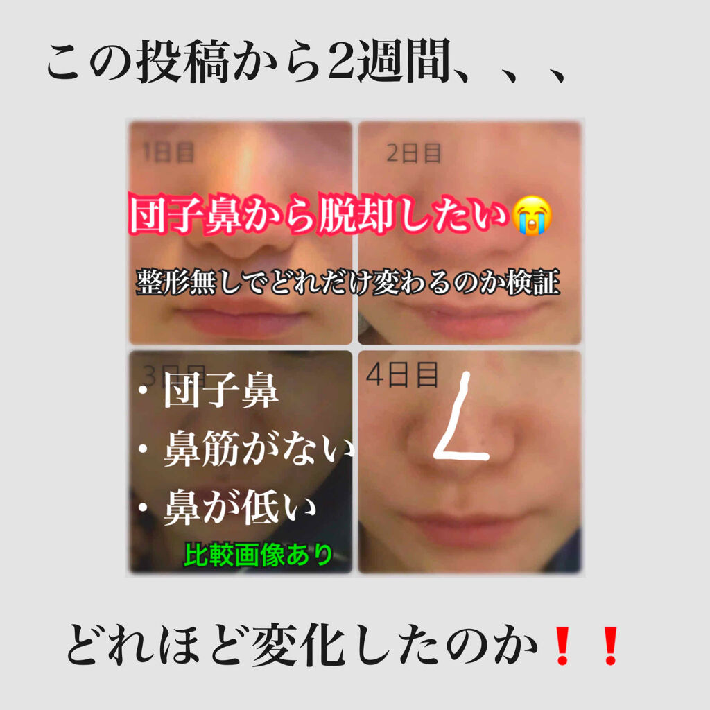 ノーズトレーナー Daisoの口コミ 団子鼻脱却計画スタートから2週間が経ちま By Riii 乾燥肌 代前半 Lips