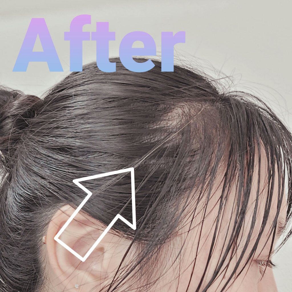 オールインワン カラートリートメント マイナチュレの口コミ 全て白髪になる前に出会えてよかった 白髪ケ By ꭾ F 混合肌 30代前半 Lips