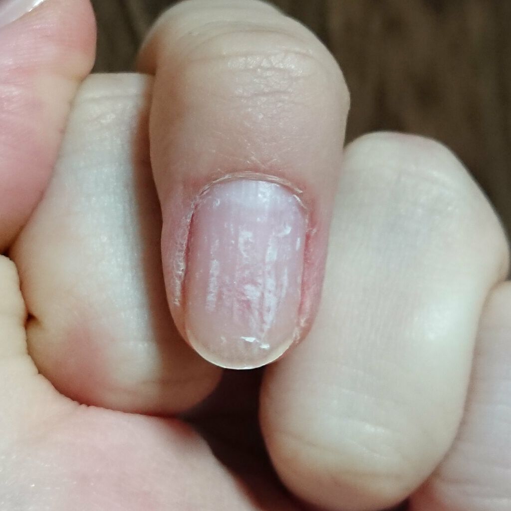 ピールオフジェル Apreの辛口レビュー 表面がもっていかれなく 長く保つということ By Ninig 乾燥肌 Lips