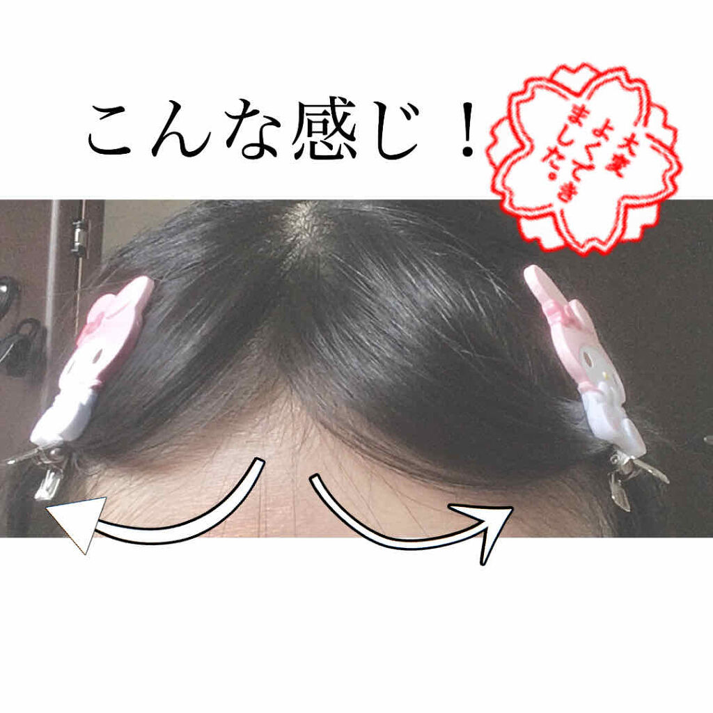 前髪クリップ サンリオの口コミ 跡がつかない前髪クリップ で 分け目 も By ほこあ 毎日ログイン フォロバ 敏感肌 代前半 Lips