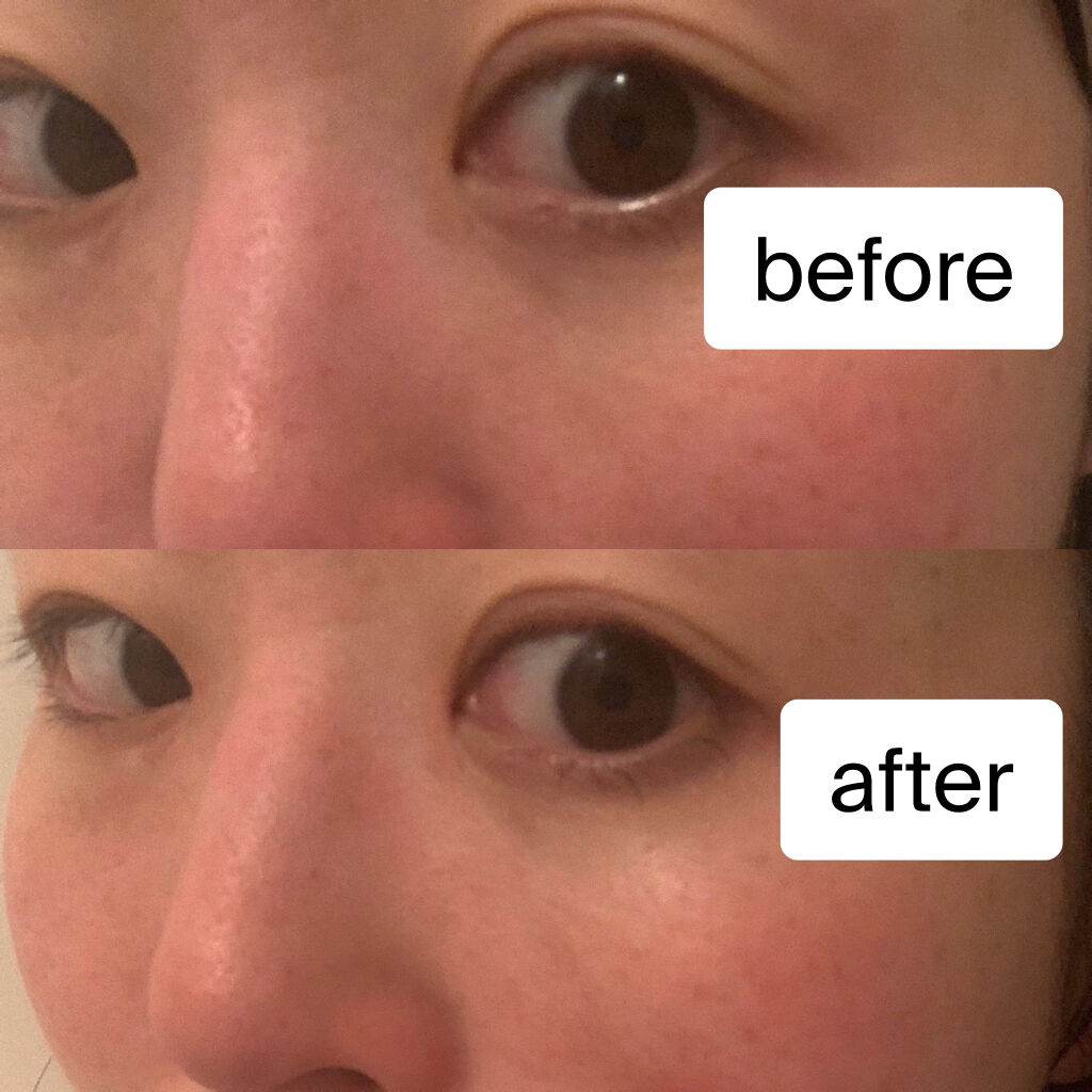 Detクリア ブライト ピール ピーリングジェリー ミックスベリーの香り 明色化粧品の口コミ 最近は花粉症と毎日のマスク生活により肌がよ By 坂本ゆか 敏感肌 代後半 Lips