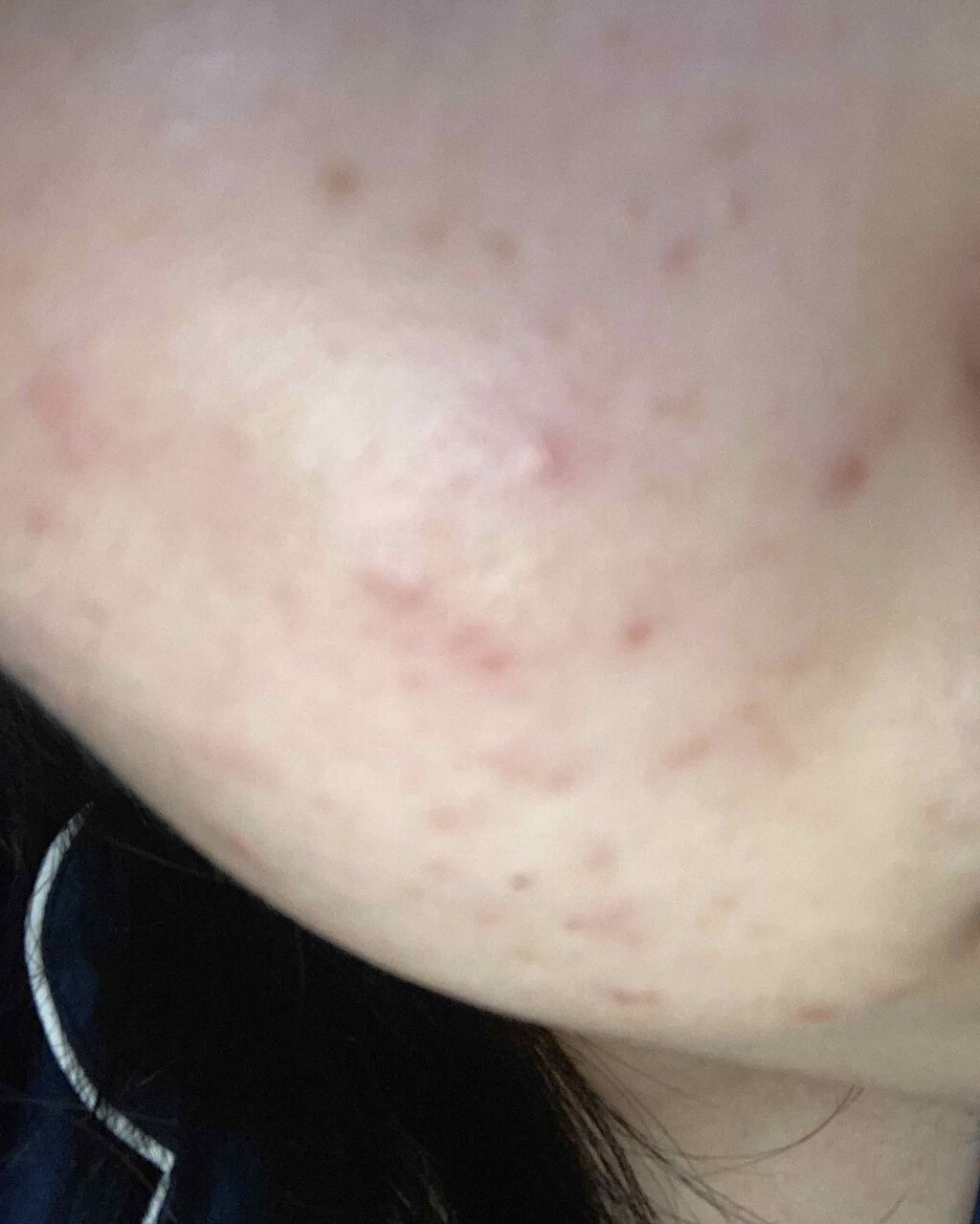 ワセリン 大洋製薬の辛口レビュー 肌断食4日目全然変わらない 誰かアドバイス By ぴよこ 敏感肌 10代後半 Lips