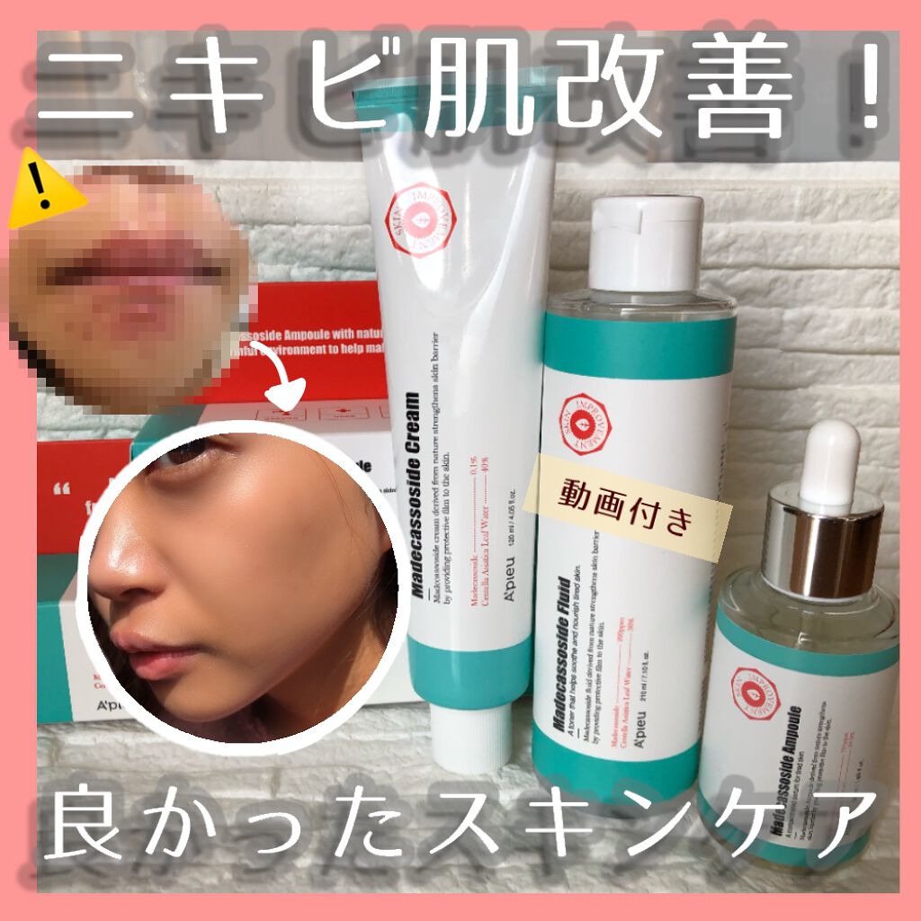 マデカソ Cica化粧水 A Pieuを使った口コミ ニキビ肌改善スキンケア こんばんは By ゆんゆん 普通肌 代前半 Lips マデカソ Cica化粧水 A Pieuを使った口コミ ニキビ肌改善スキンケア こんばんは By ゆんゆん 普通肌 代前半 Lips