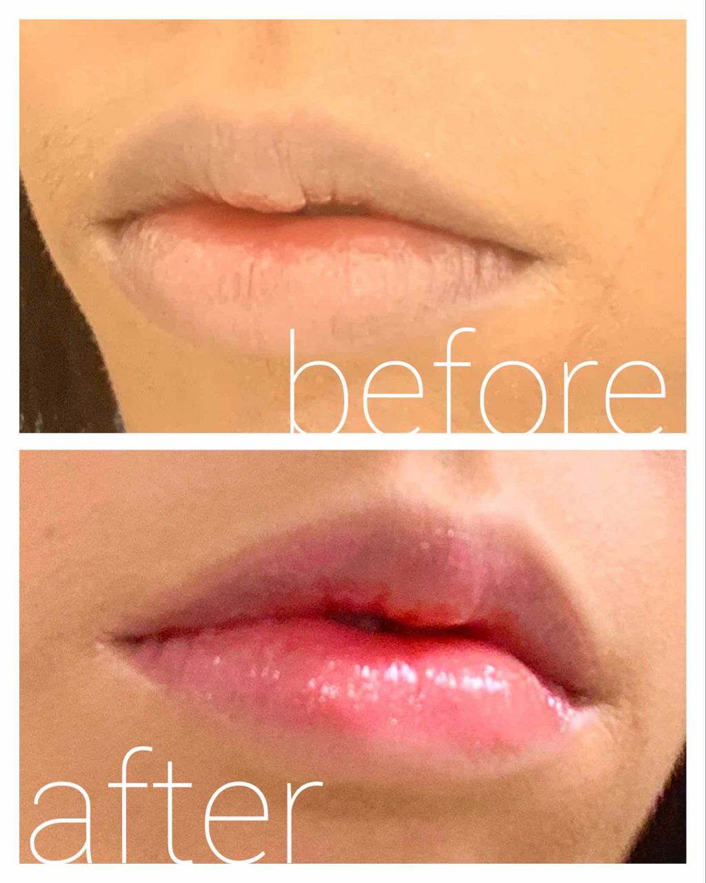 メルティーリップセラム プランプピンクの口コミ ブルベにおすすめのリップグロス プチプラで発見 グラデ By かめじ 敏感肌 Lips