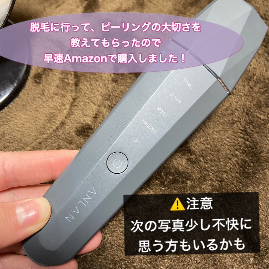 ウォーターピーリング超音波美顔器 Anlanの使い方を徹底解説 以前から気になっていたピーリング 脱毛に行 By ちー 敏感肌 代前半 Lips