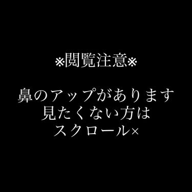 炭 鼻の毛穴ジェルパック Daisoのリアルな口コミ レビュー Lips