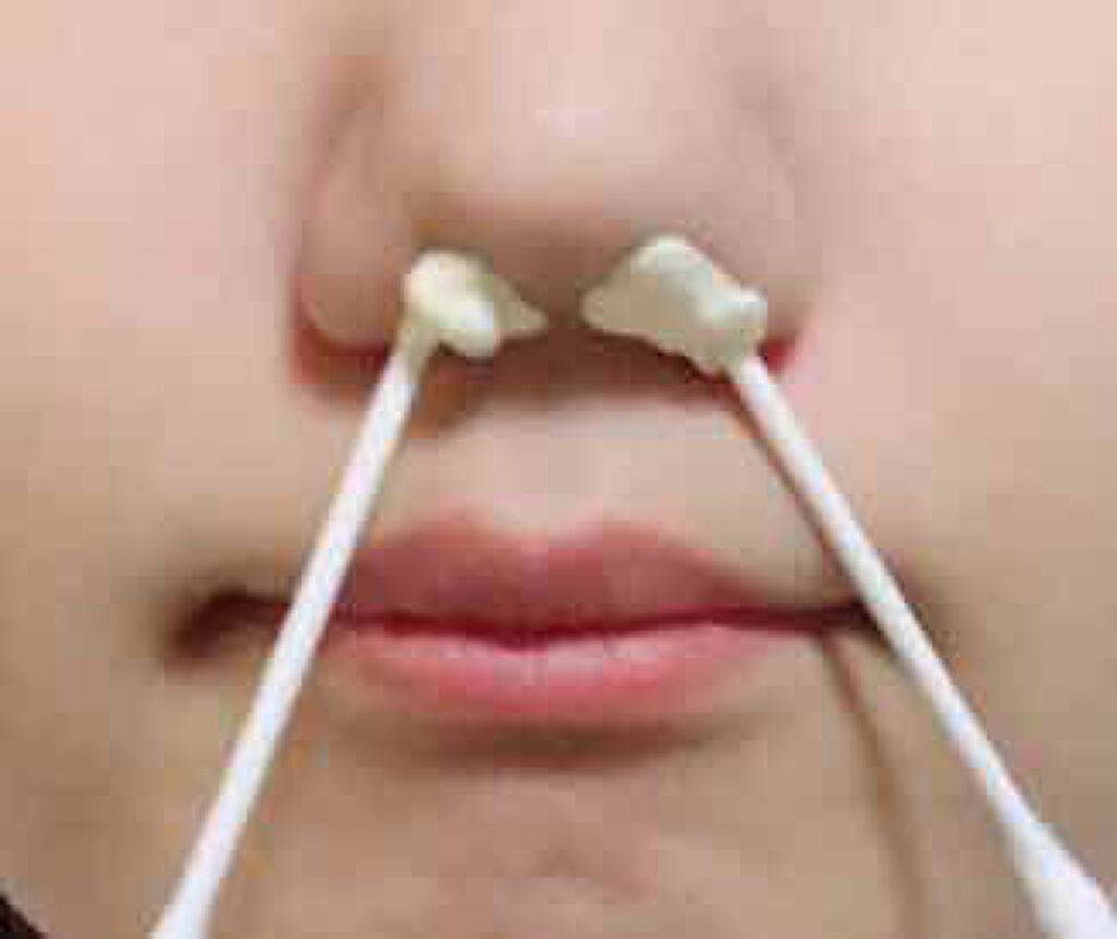 ｇｏｓｓｏブラジリアンノーズワックス 10回分 ｇｏｓｓｏ ゴッソ の口コミ 2 の大人買い 綿棒だと奥まで突っ込ん By みやたん 乾燥肌 代後半 Lips