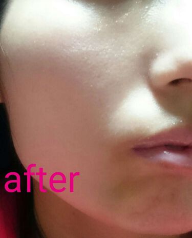 モイスチャー サージ Cc クリーム 30 Cliniqueの口コミ イエベ春におすすめのccクリーム 04フレッシュピンク使 By かな 混合肌 Lips