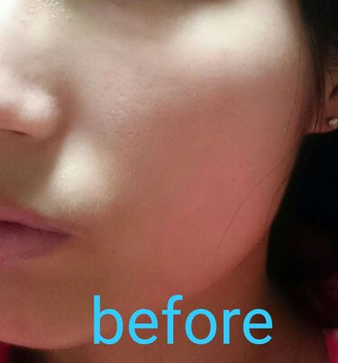 モイスチャー サージ Cc クリーム 30 Cliniqueの口コミ イエベ春におすすめのccクリーム 04フレッシュピンク使 By かな 混合肌 Lips