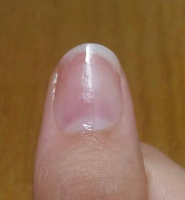 クイックケアコート Ettusaisの口コミ ジェルネイルでボロボロになった爪を休憩させ By あーにゃ 乾燥肌 30代前半 Lips