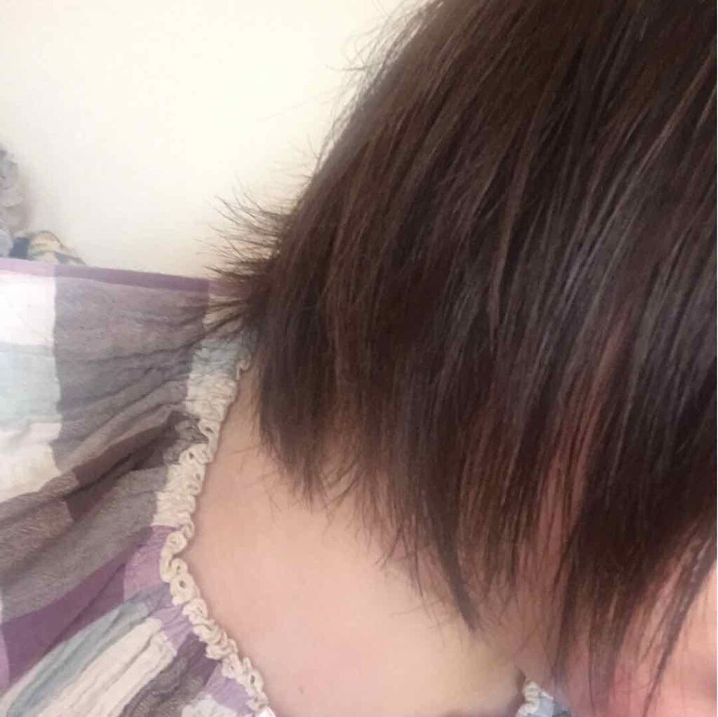 モルティ 薬用育毛ローション モウガlの使い方を徹底解説 26になるので 髪の毛のエイジングケア始め By 眞弥 混合肌 代後半 Lips