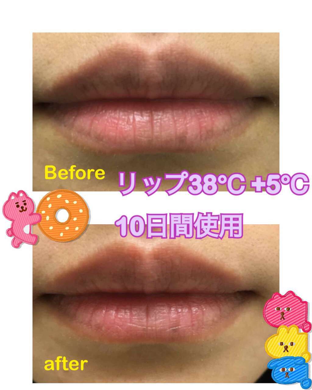 38 C 99 F Lip Treatment Uzu By Flowfushiの口コミ フローフシlip38 5 10日間使用使 By こむぴ 乾燥肌 代後半 Lips