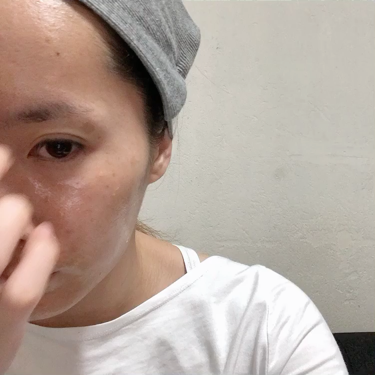 カレンデュラ ピール