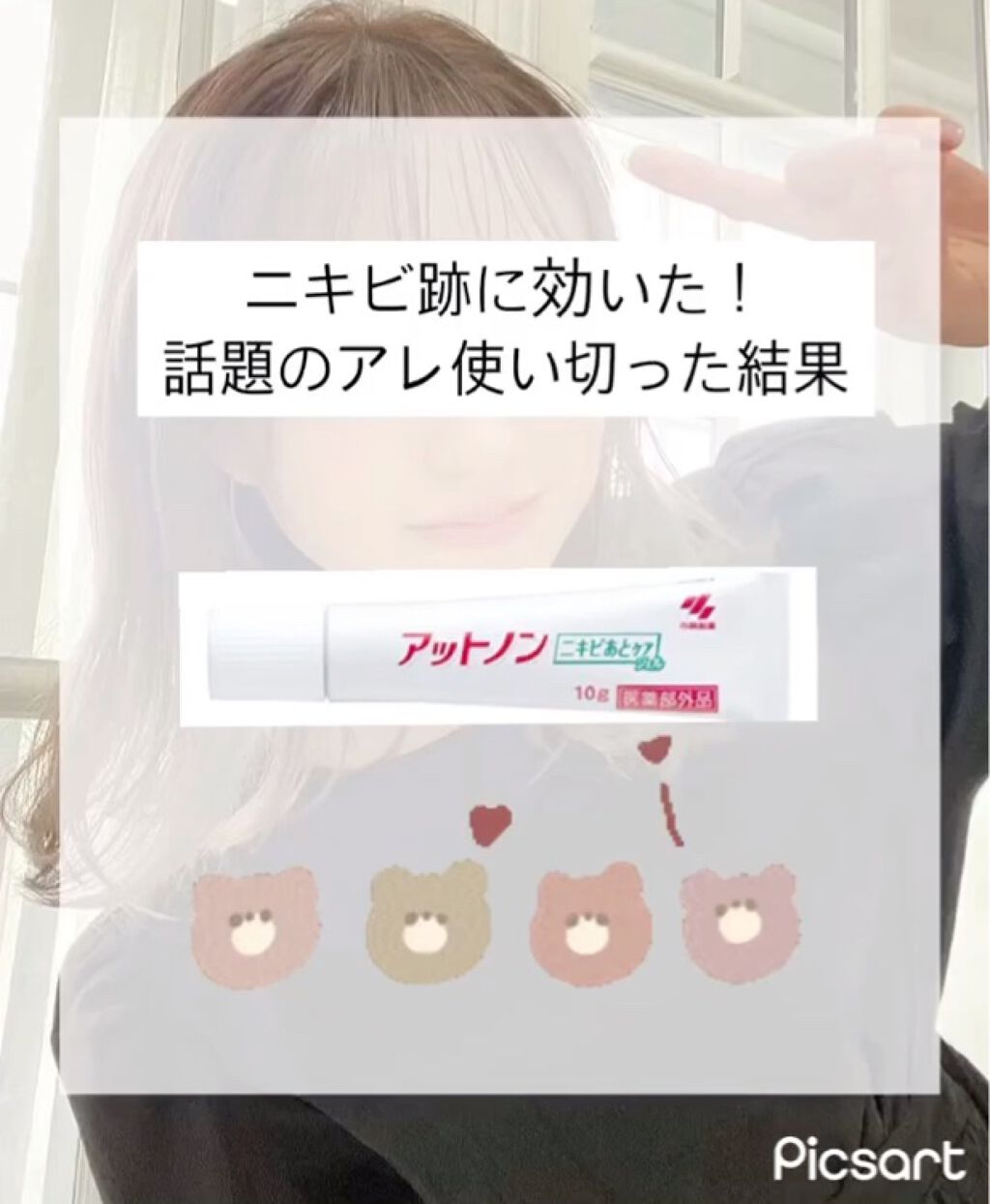試してみた ニキビあとケアジェル アットノンのリアルな口コミ レビュー Lips