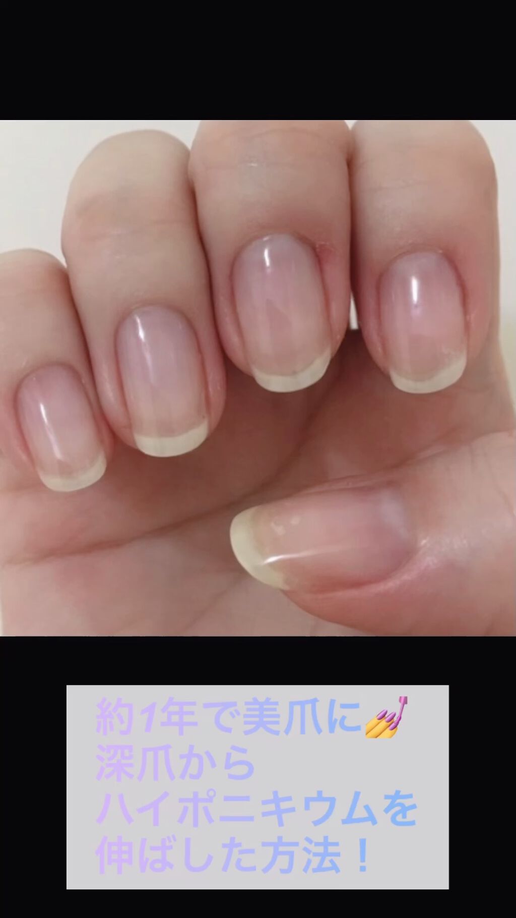 爪やすり 無印良品を使った口コミ 短い爪の人へ ピンクの爪を伸ばす方法今回 By 95号 普通肌 Lips