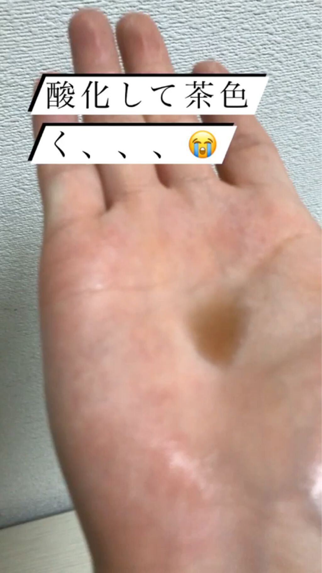 試してみた 業務用ハイドロキノン 旭研究所のリアルな口コミ レビュー Lips