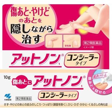 アットノン コンシーラータイプ 16年4月6日発売 医薬品 アットノンのリアルな口コミ レビュー Lips