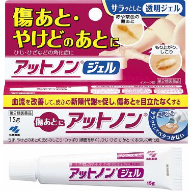 アットノン 医薬品 アットノンのリアルな口コミ レビュー Lips